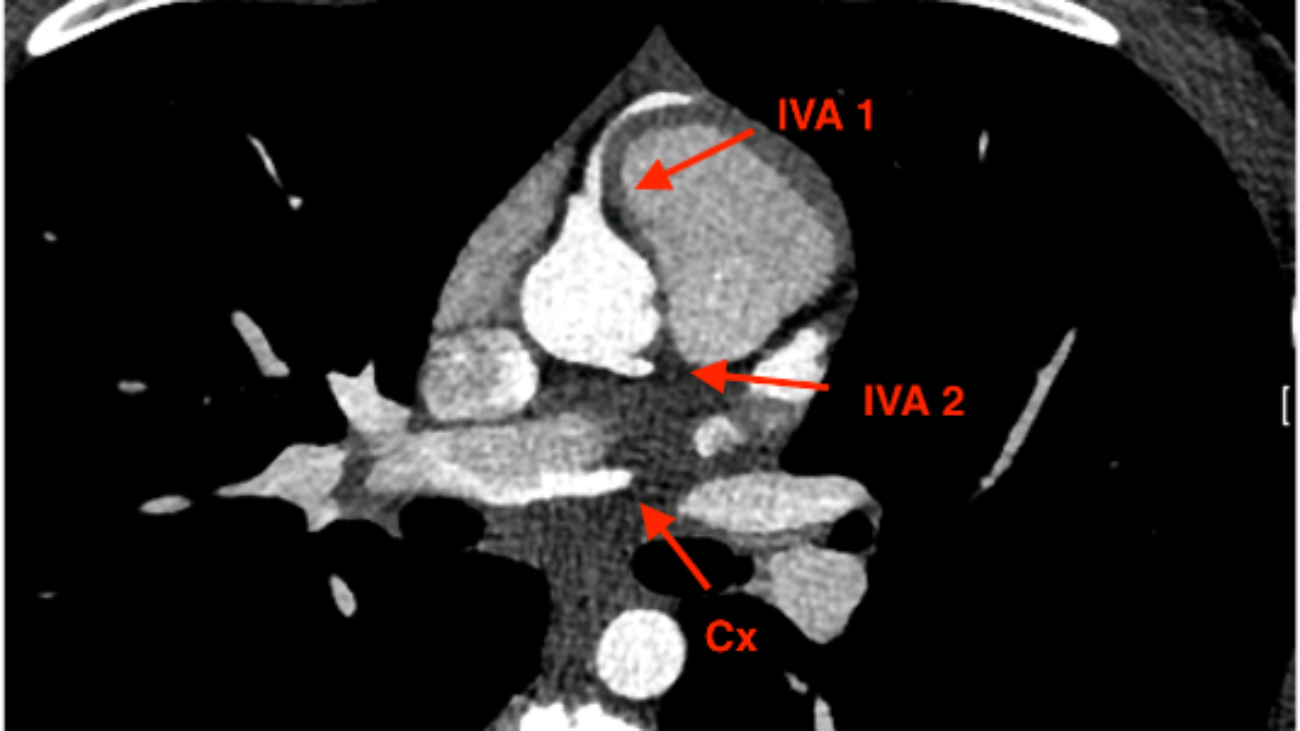 figura-4