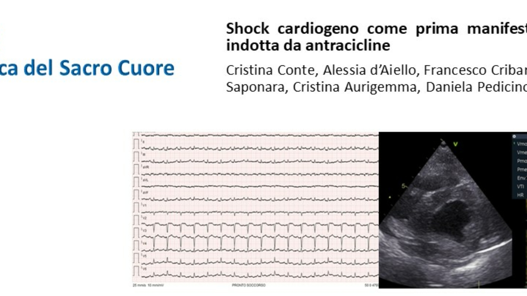 shock_cardiotos_20230414