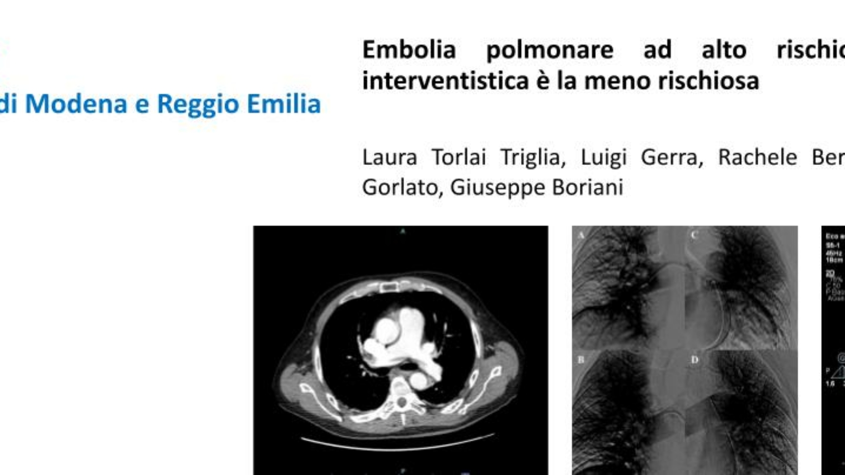 emboliaReggio